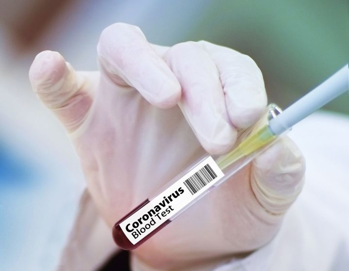 В Роспотребнадзоре сообщили о ряде рекомендаций после вакцинации от COVID-19