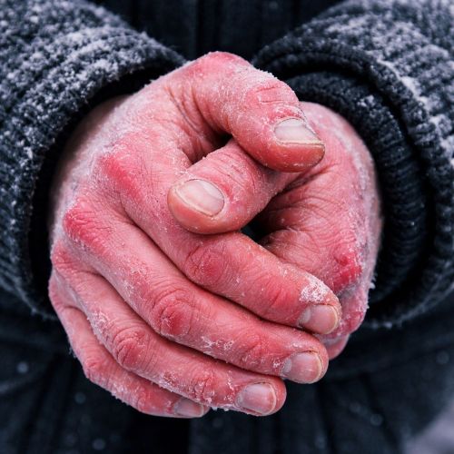 Чем опасны трещины и покраснения на коже рук от мороза: объяснение врача-аллерголога